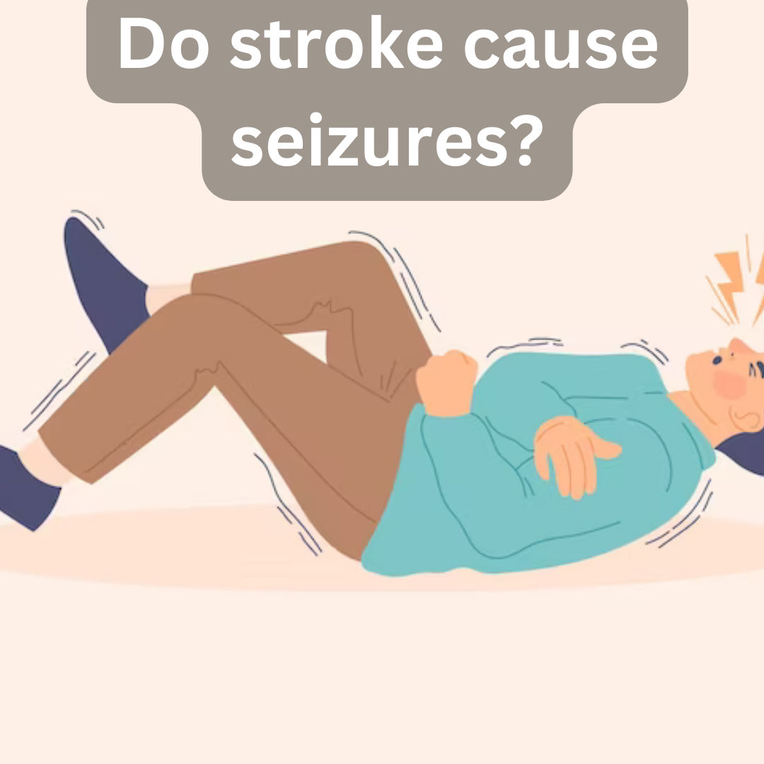 Do stroke cause seizures?