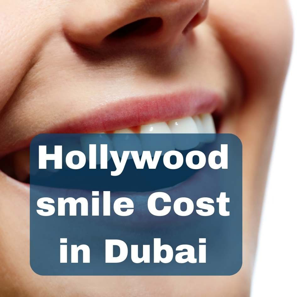 hollywood smile cost
