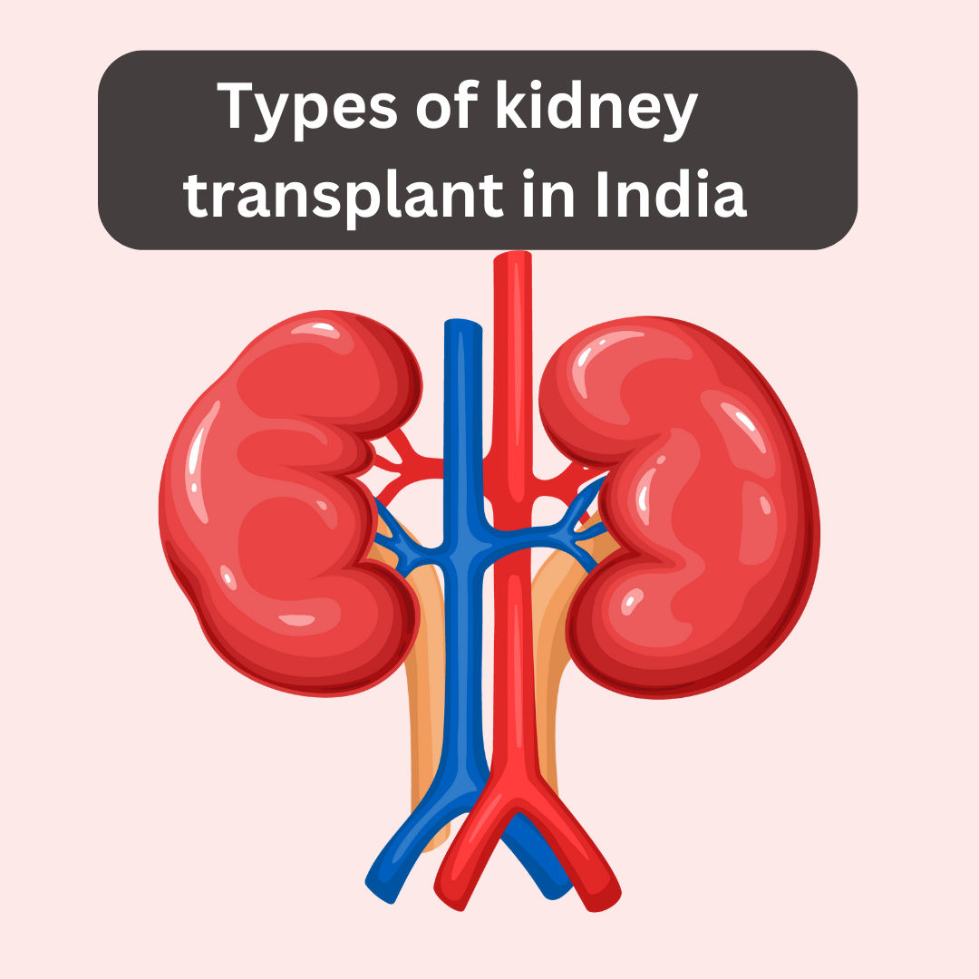the types of kidney transplants