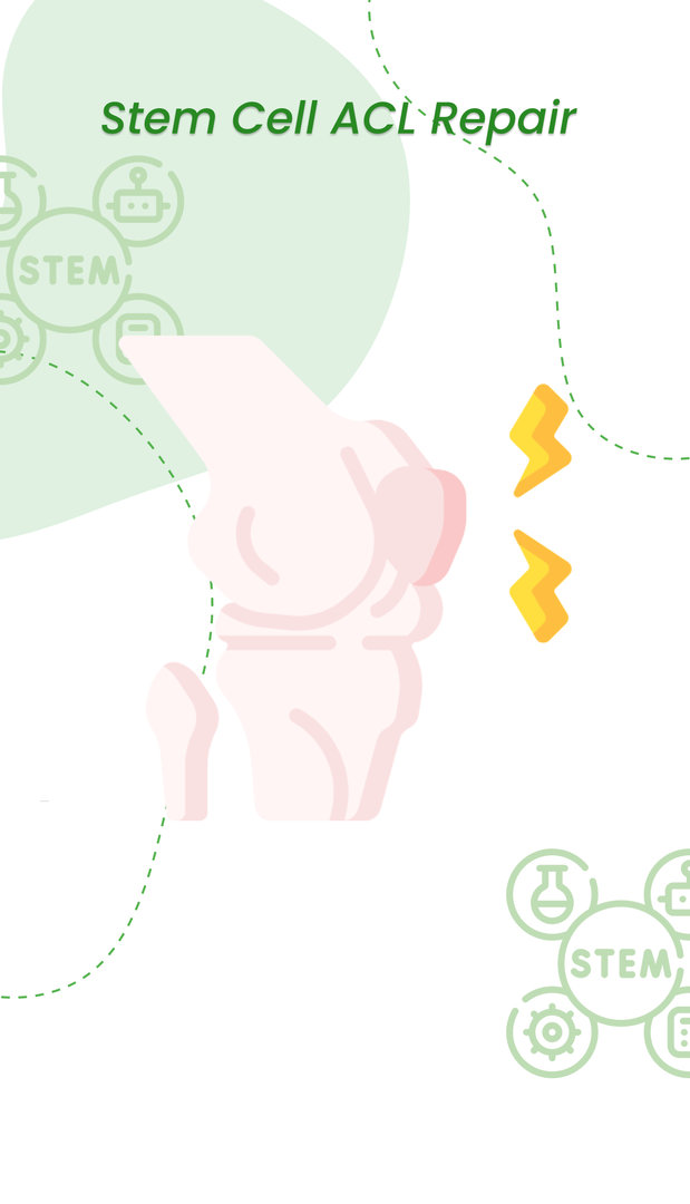 Stem cell ACL Repair