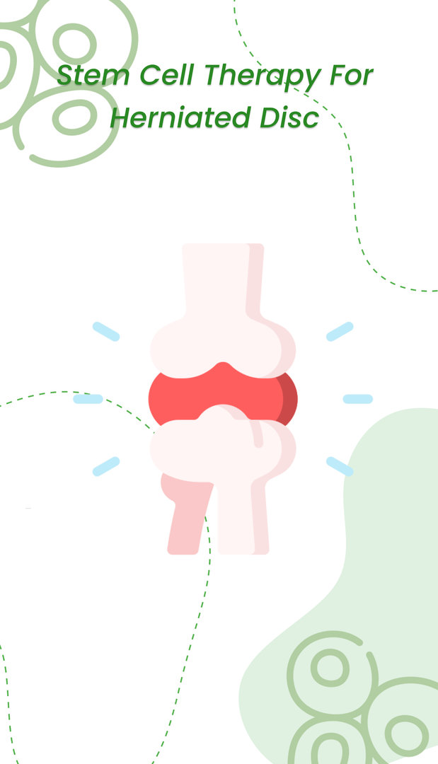 Stem cell therapy for herniated disc