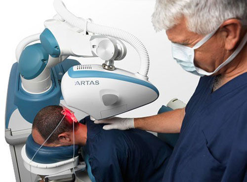 What is Robotic Hair Transplant?