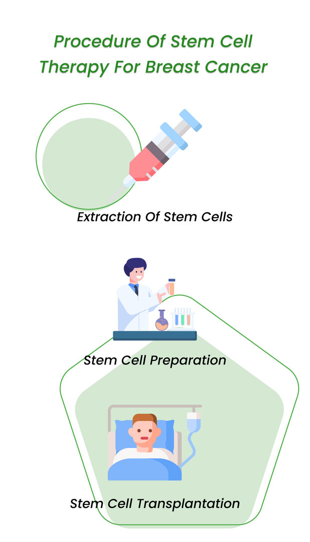 Procedure of stem cell therapy for breast cancer