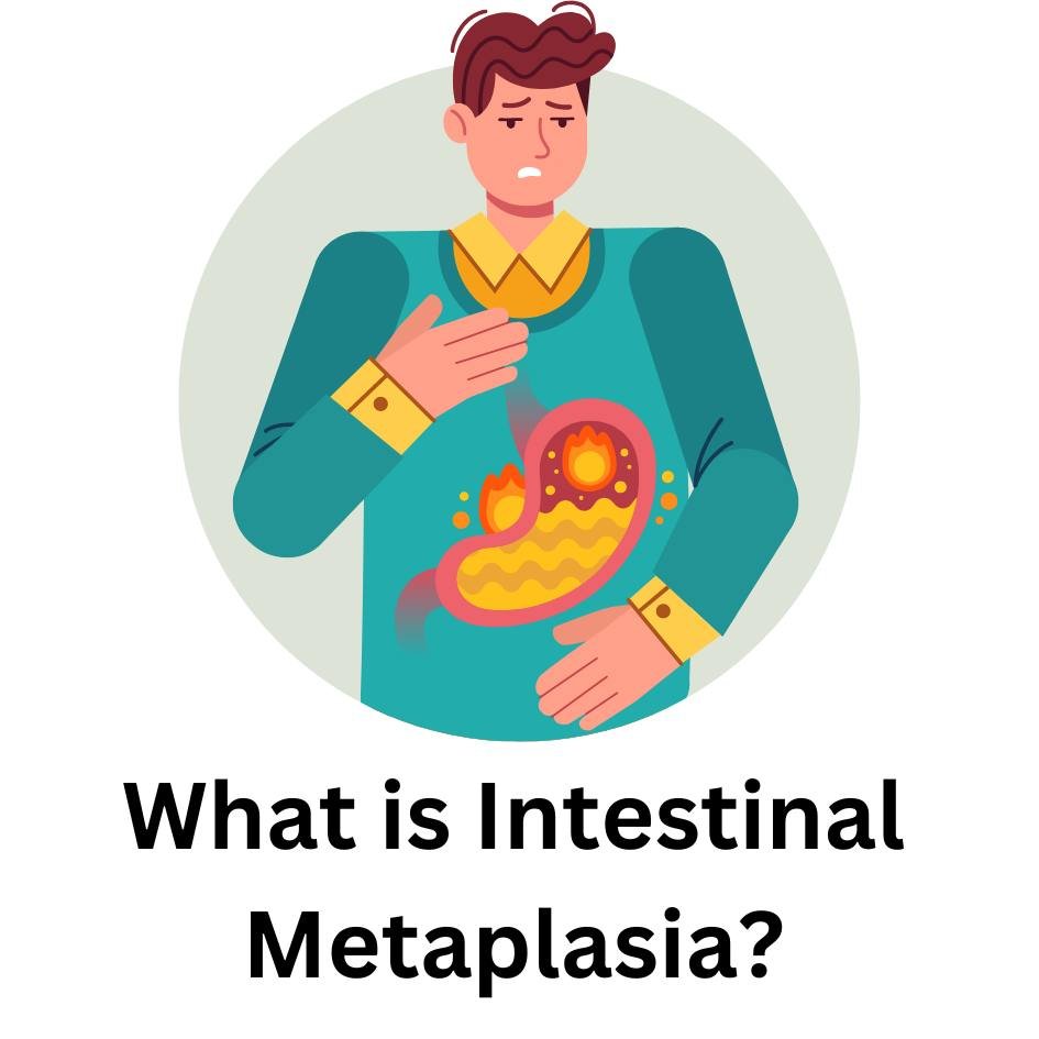 What is Intestinal Metaplasia? 