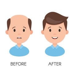 why hair transplant in Mexico?