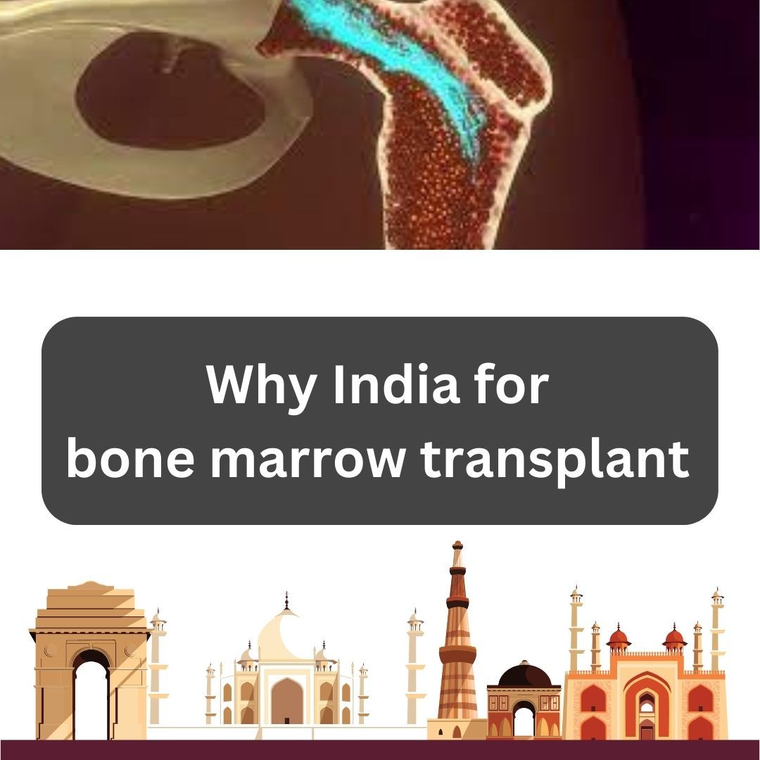 Why choose India for a bone marrow transplant?