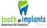 Tooth N Implants