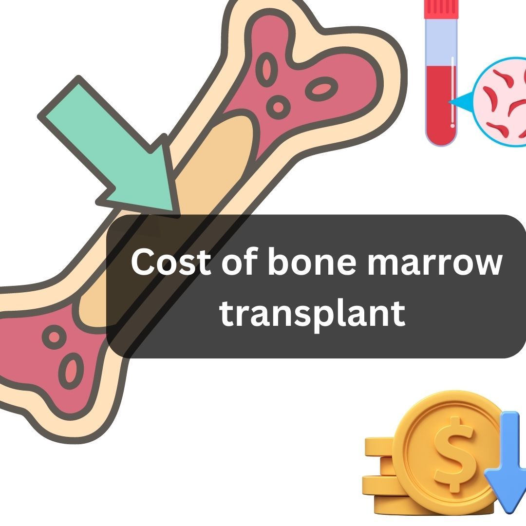 Bone Marrow Transplant Cost in India 