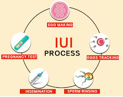 iui process