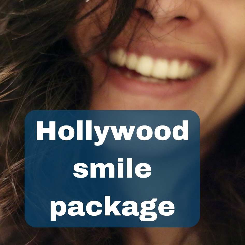 hollywood smile package