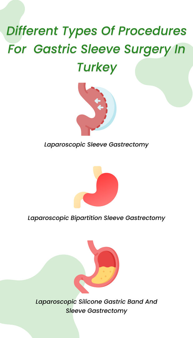 Different types of procedure for gastric sleeve turkey 